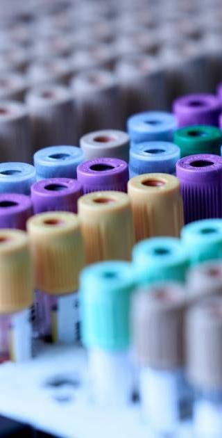 Labcorp betaalt boete en verbetert databeveiliging na datalek